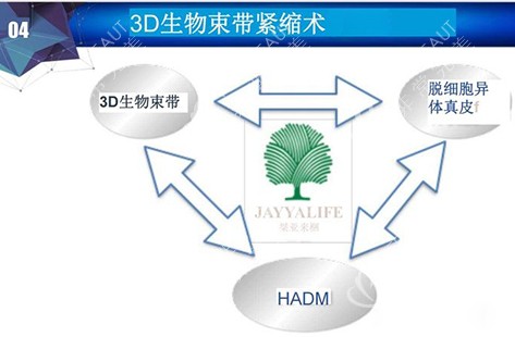 3d生物束带缩小费用(3d生物束带紧缩术注意事项)