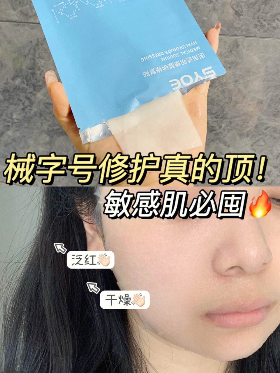 做个降敏手术多少钱(做个降敏手术多少钱费用)